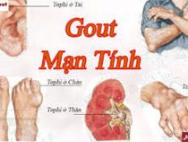 Tổng hợp các biến chứng của bệnh gout