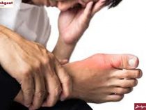 Triệu chứng đầu tiên của bệnh gout là gì?